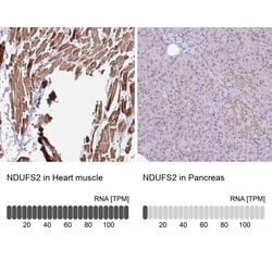 NDUFS2 Antibody, Novus Biologicals:Antibodies:Primary Antibodies